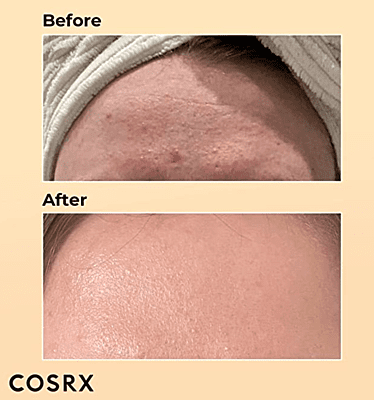 COSRX Snail Mucin 96% Power Repairing Essence 3.38 fl.oz, 100ml, Hydrating Serum for Face with Snail Secretion Filtrate for Dark Spots and Fine Lines, Korean Skincare COSRX Snail Mucin 96% Power Repairing Essence 3.38 fl.oz, 100ml, Hydrating Serum for Face with Snail Secretion Filtrate for Dark Spots and Fine Lines, Korean Skincare